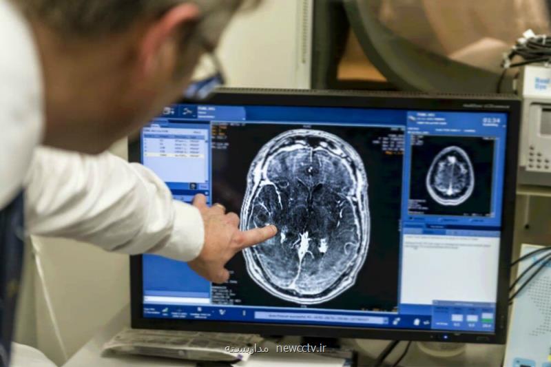 موفقیت پژوهشگران ایرانی در عرضه مدل جدید شناخت مکانیزم صدمه مغزی