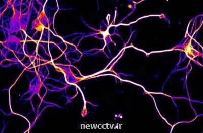 ابداع روشی نوین برای بهبود اعصاب لطمه دیده