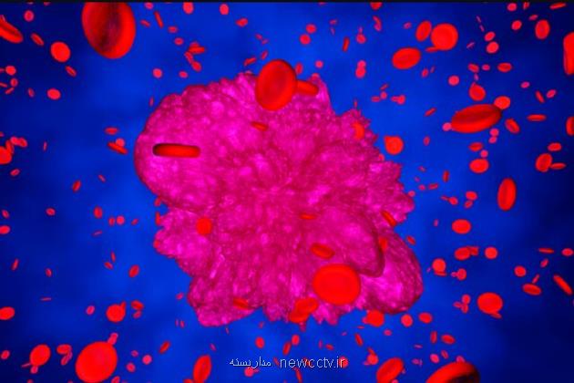 نتایج مثبت یک درمان جدید سرطان خون بر 73 درصد از بیماران
