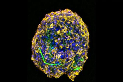 درمان صدمه نخاعی در موش ها با کره های سلولی سه بعدی