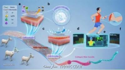 نظارت بر بدن با پوست الکترونیکی جدید