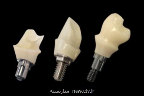ایمپلنت دندانی تولید می شود، ورود به بازار تا سال ۹۸