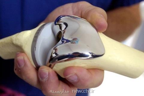 طول عمر پروتز زانو و لگن افزایش یافت