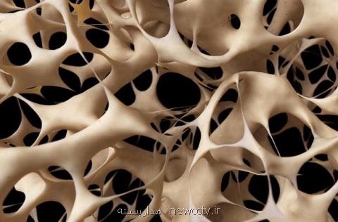كشف نقش موثر سلول های چربی در ترمیم استخوان