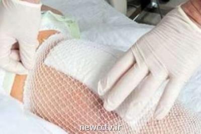 ژل ترمیم كننده زخم نانویی از سخت پوستان دریایی تولید شد