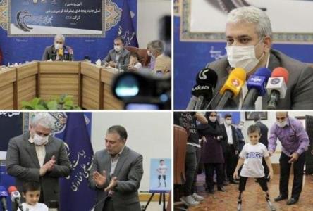 پنجه های كربنی ورزشی برای بیماران قطع عضو رونمایی گردید